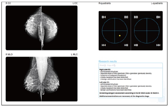 [시장분석] 인공지능·원격의료가 주도하는 러시아의 디지털 헬스케어.jpg